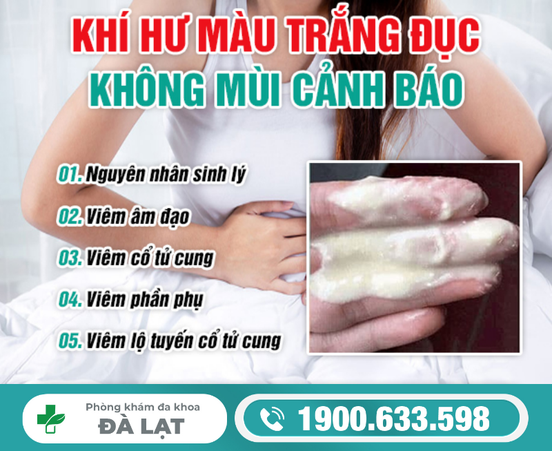 Hình ảnh minh họa